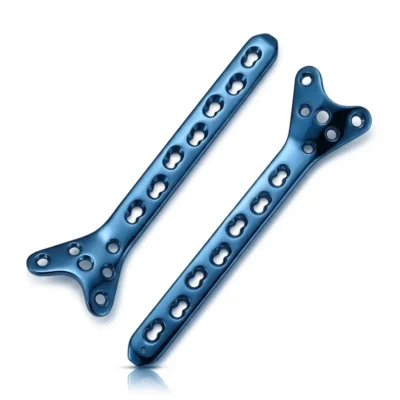 Two blue-colored Condylar Buttress Locking Plates arranged diagonally in opposite directions