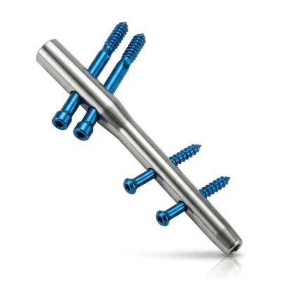 Silver-coloured Trochanteric Femur Nail with four blue screws on a white background.