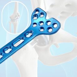 Orthopedic Implants